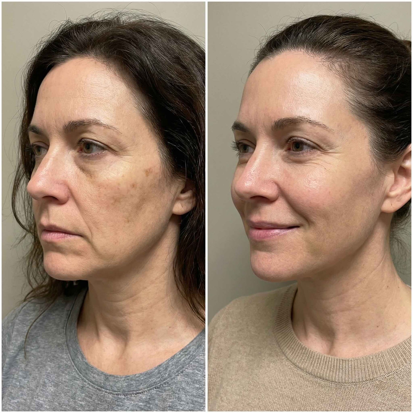 Bálsamo de Calcio 4 en 1 Efecto Lifting Instantáneo - CALCIUM LUXE™